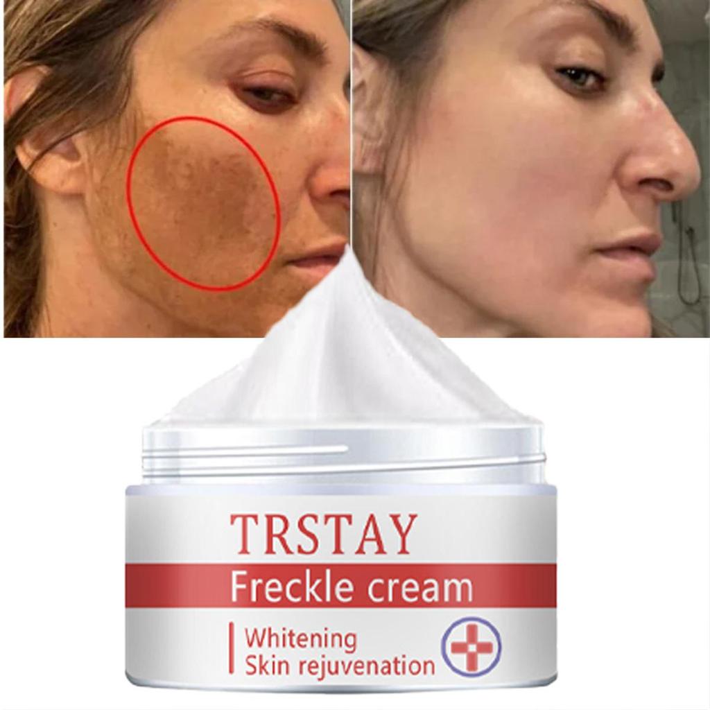 A Hydrating Moisturizing Cream To Make It Look Smoother and Less Wrinkled, an Essential Part of Your Daily Facial