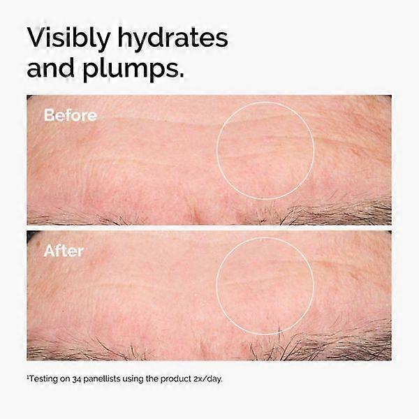 The Ordinary Hyaluronic Acid 2% + B5 Serum, Plumping Hydration With Ceramides, 1 Fl Oz