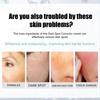 EELHOE Whitening Freckle Cream Nicotinamide Dark Spot Remover Moisturizing Skin Care Brightening Anti-Aging Face Beauty Care 50g