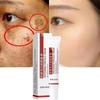 Crema Schiarente Viso Efficace Rimuove Melasma Macchie Scure Migliora Opacità Pelle Anti-pigmentazione Crema Trattamento Prodotti per la Cura