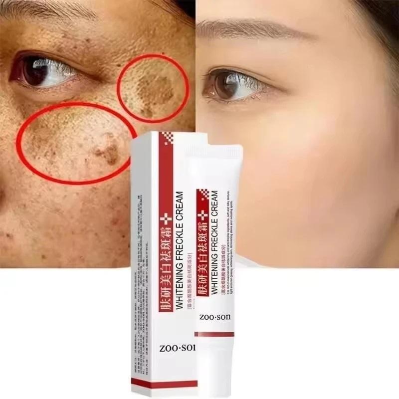 Whiten Cream Brighten Face Effective Remove Melasma Dark Spot Improve Dullness Skin Anti-pigmentation Care Cream Care Products