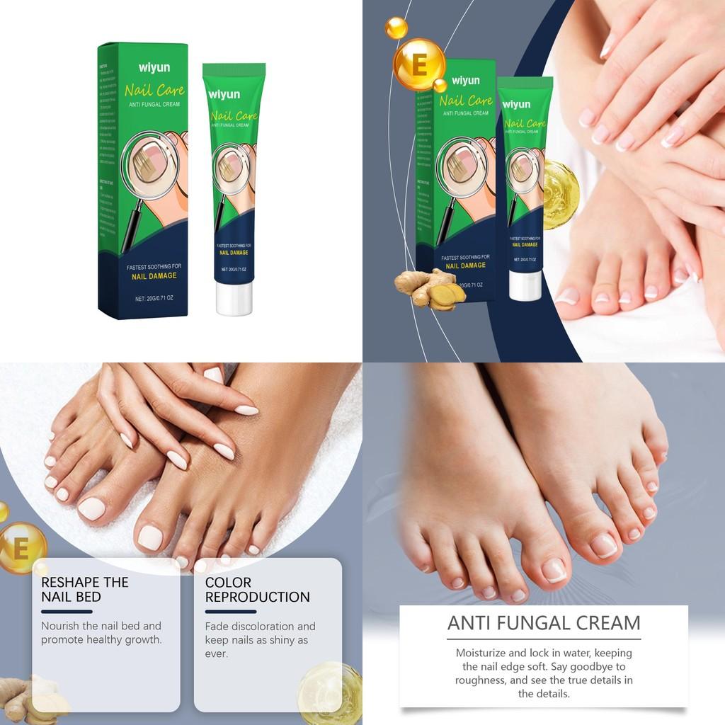 Nourishing Wiyun Nail Care Repair Cream For Shiny Healthy Nails And Soothing Comfort