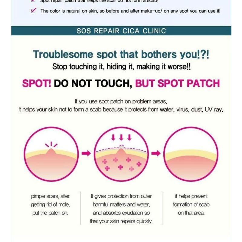 TOSOWOONG - SOS Repair Cica Clinic Acne Patch 66pcs