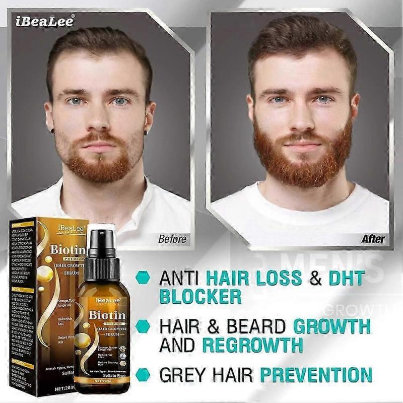 Biotin Hair Growth Spray Anti Hair Loss Fast Regrowth Scalp Treatment Serum