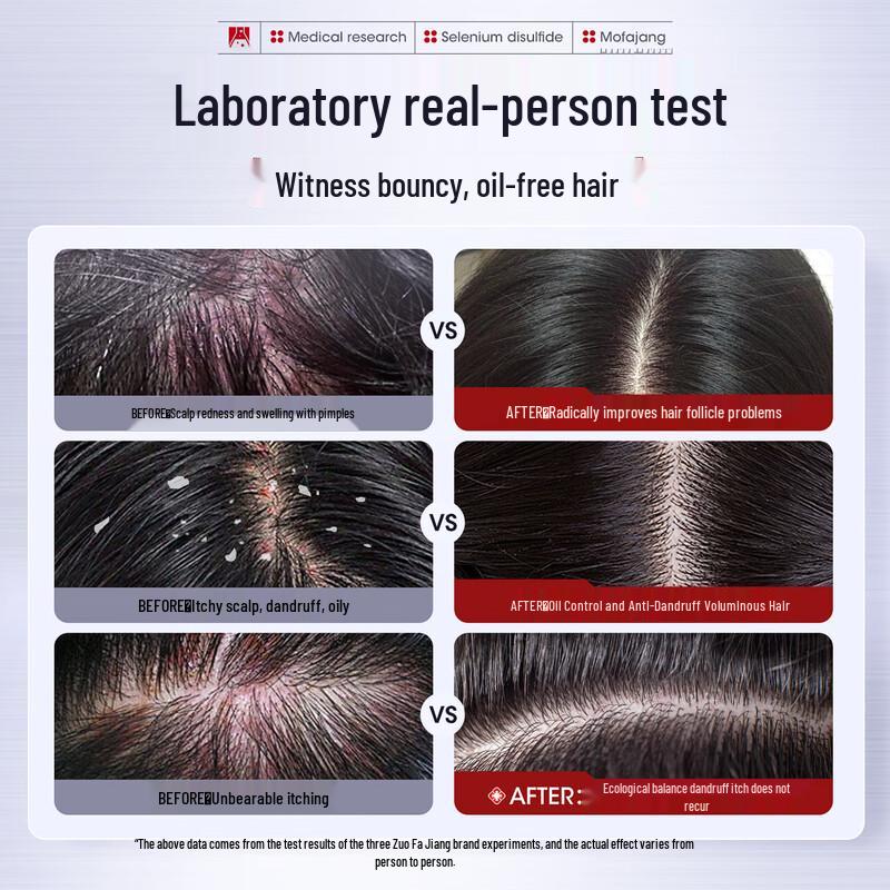 Șampon cu Disulfură de Seleniu Trei Meșteri Magici