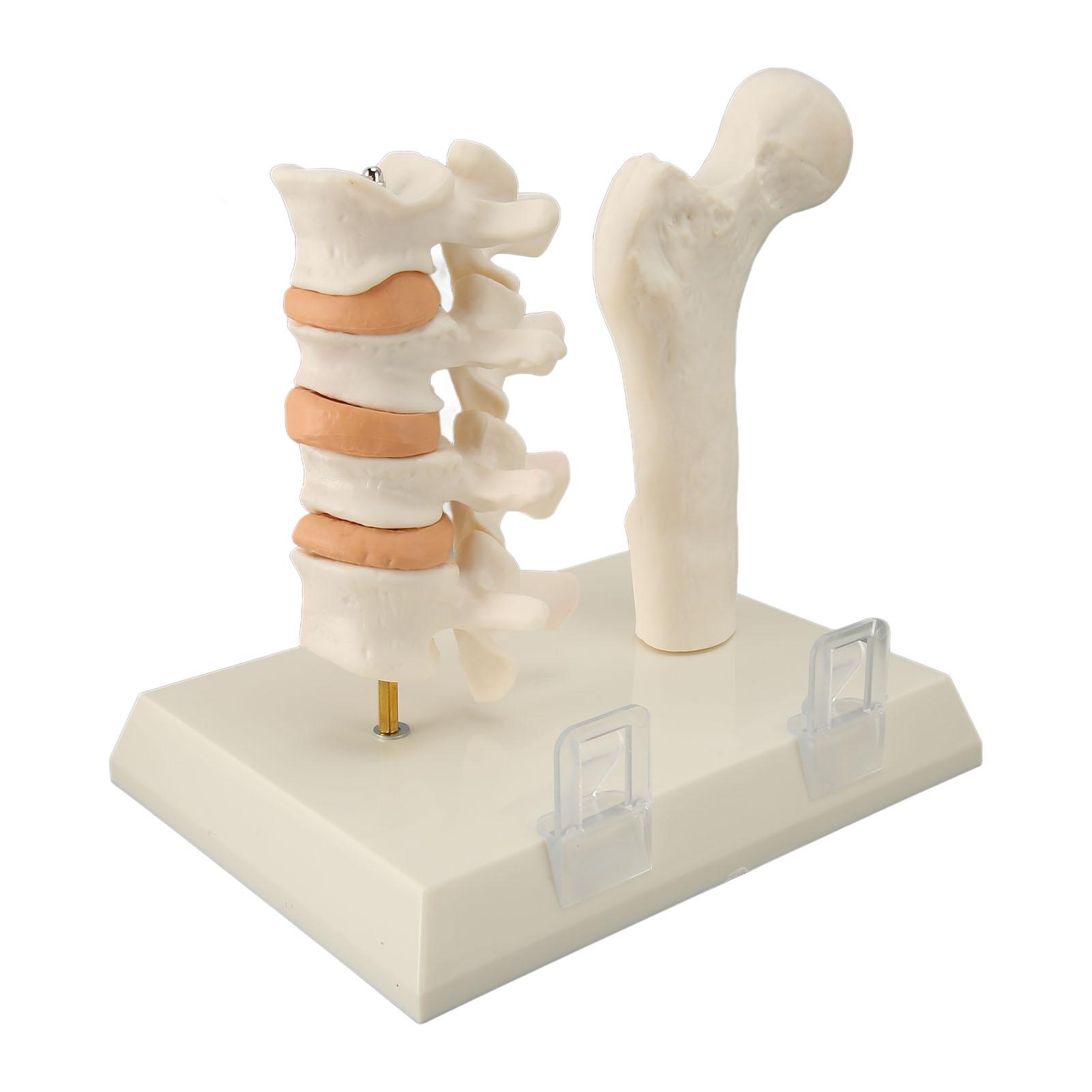 

Модель позвоночника при остеопорозе, демонстрирующая образовательную модель поражения остеопорозом для клинического обучения