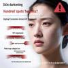 Douyin 377 Niacinamide Whitening & Firming Cream: Anti-Wrinkle, Hydrating, Moisturizing, and Spot-Removing Face Cream