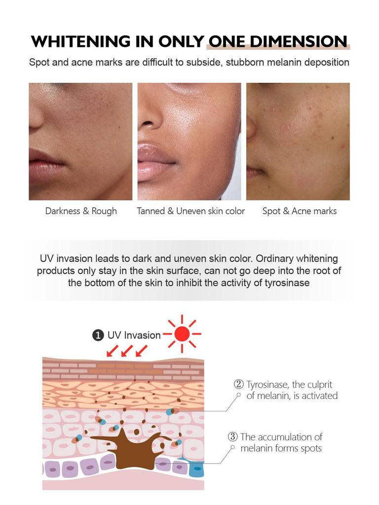 Strahlende Glamour Arbutin Aufhellende Essenz: Hellt dunkle, ungleichmäßige Haut auf