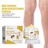 Bee Venom Anti-Varicose Soothing Cream with Vitamin K, Reduces Swelling & Spider Veins, Leg Care Cream, 100ml
