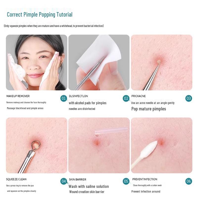 Ultra-fine Blackhead Removal Set: Precision Tweezers, Comedone Scraper, Beauty Pick, and Acne Needle Tools