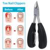 Toenails Trimmer Toenail Care Clippers for Ingrown or Thick Nails Cuticle Nipper Trimmer Old Man Protective Paramedic Scissors