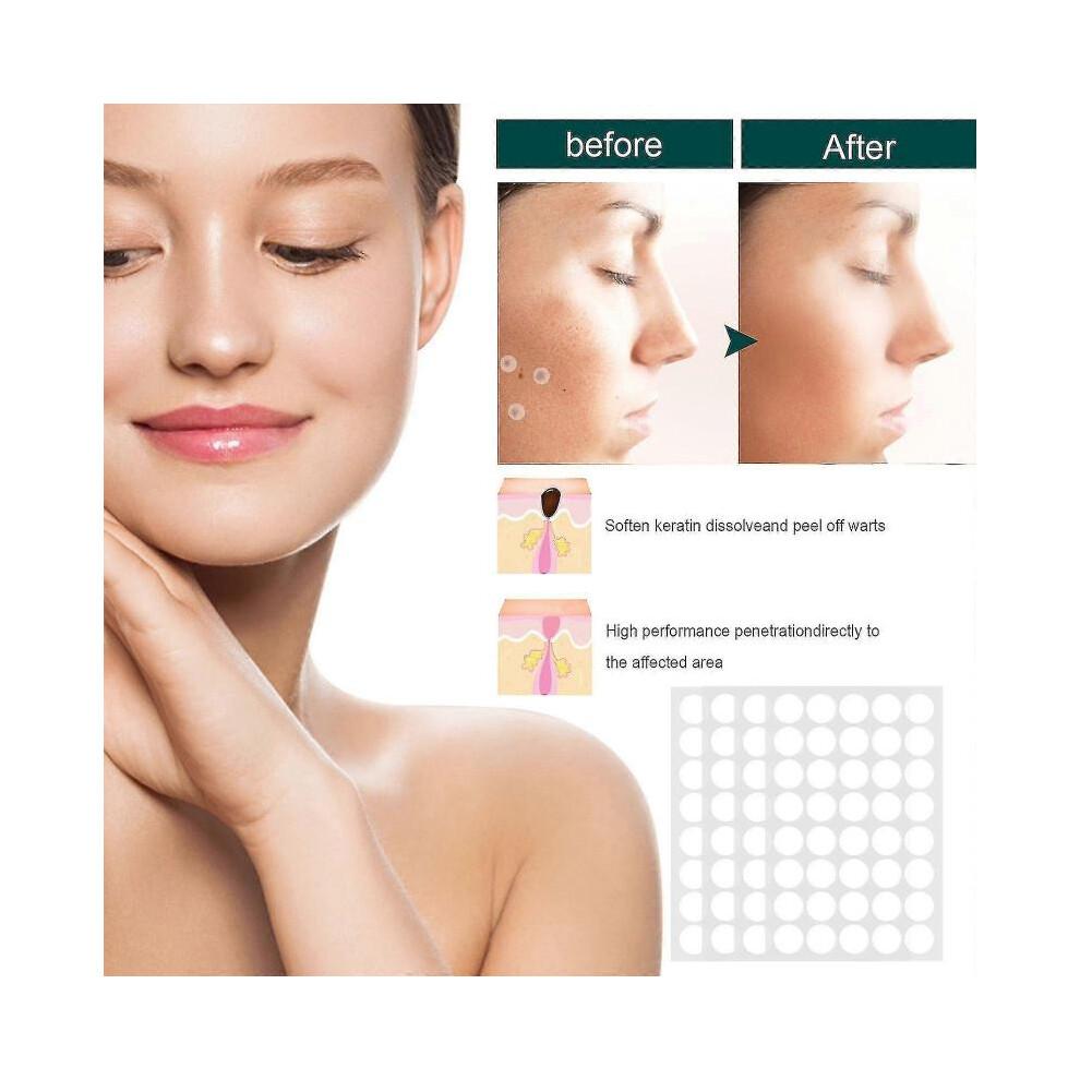 Natural Safe And Effective Ingredients Skin Tag Remover Patches And Improved Formulations Skin Tag Remover Patches