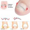 Ingrown Toenail Correction Tool Straightening Clip Brace Ingrown Toe Nail Treatment Elastic Patch Sticker Pedicure Tool