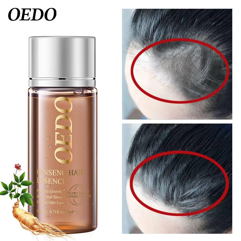Ginseng Strengthen Hair Essential Oil Repair Damaged Hair Hair Repair Hair Care Products