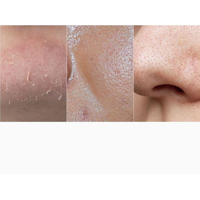 APRILSKIN - Carrotene IPMP Hydramelt Cleansing Balm