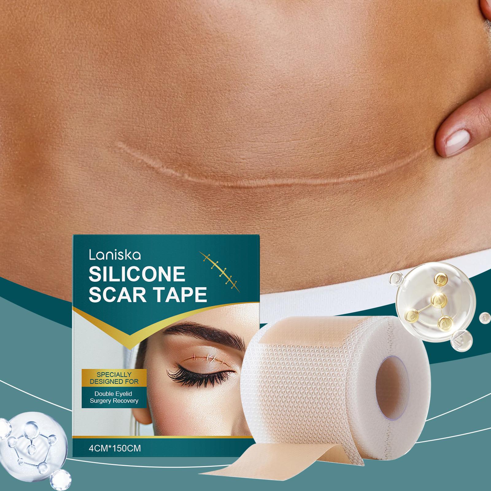 Silicone Scar Sheets Skin Repair Patch Removal Self-Adhesive Stretch Mark Tape Acne Scar Skin Care Therapy Patch Burn 1pc