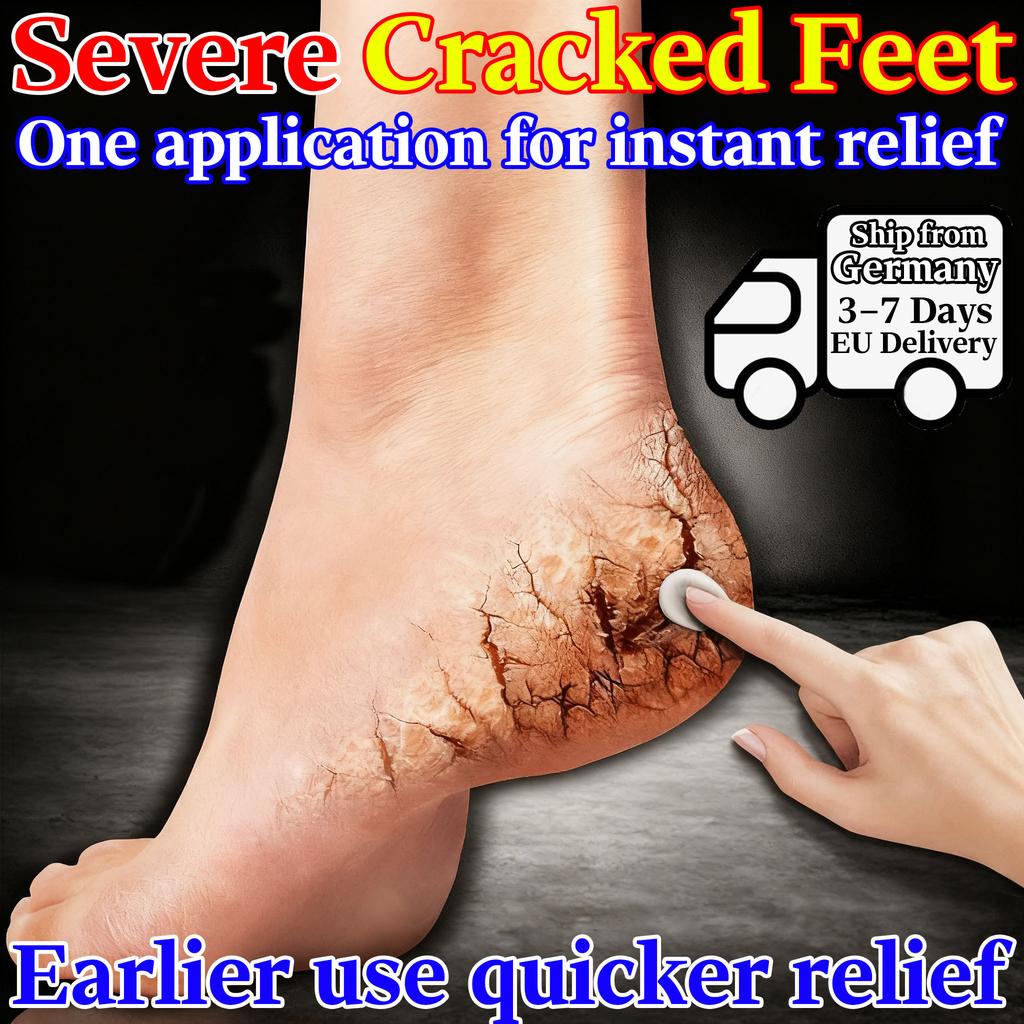 Djupt Återfuktande Serum för Torra Sprickiga Händer Fötter - Naturlig Örtblandning