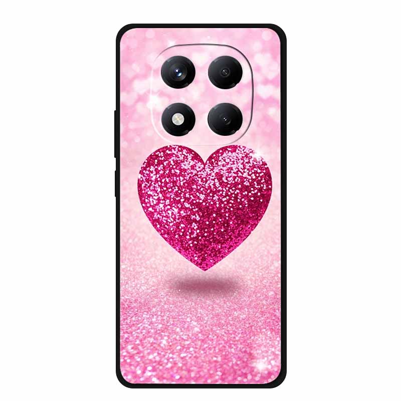 For Redmi Note 15 Case China Version 6.77" Camera Lens Protector Silicone Soft Cover Funda for Redmi Note 15 5G Coque New Note15