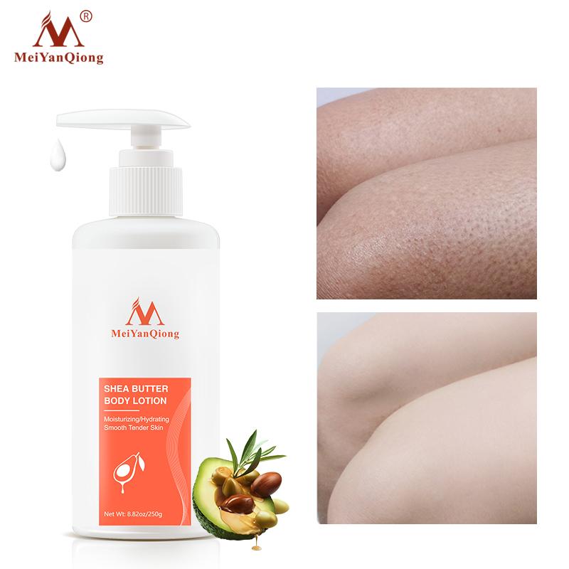 Super Shea Butter Moist Body Lotion Body Creams Moisturizing Skin Care Improve the Skin Dry and Rough Whiteing Ant-Aging Cream