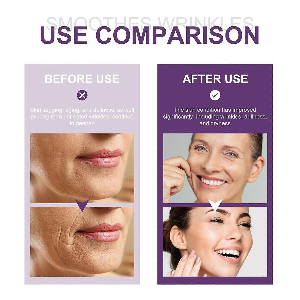 Limited time!!Eelhoe Retinol Facial Serum Anti-Wrinkle, Whitening, Moisturizing, Brightening Skincare Facial Oil