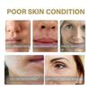 EELHOE Collagen Essence Improves Facial Skin, Lightening Fine Lines, Hydrating, Firming And Anti-Wri