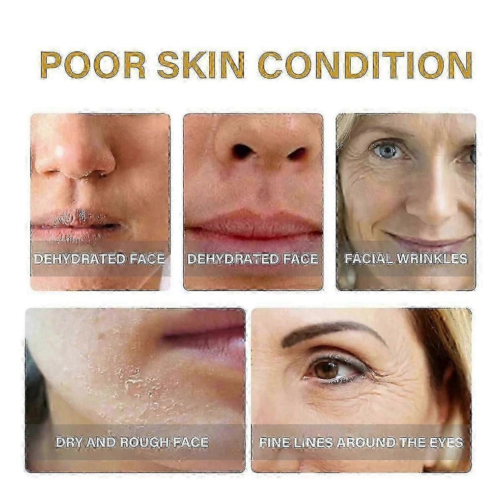 EELHOE Collagen Essence Improves Facial Skin, Lightening Fine Lines, Hydrating, Firming And Anti-Wri
