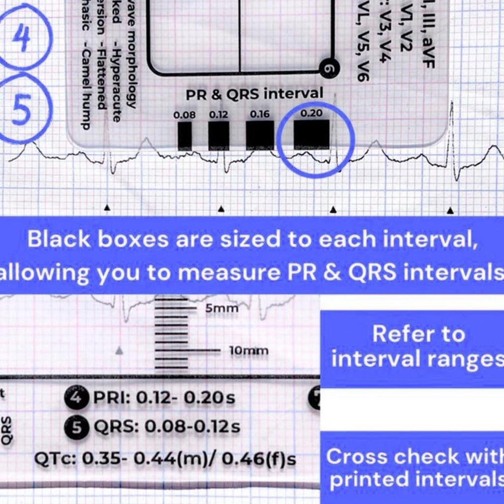 Professional Pocket Card 7 Step Ruler For Easy Electrocardiogram Assessment Reference Guide Efficient Heart Data Reading