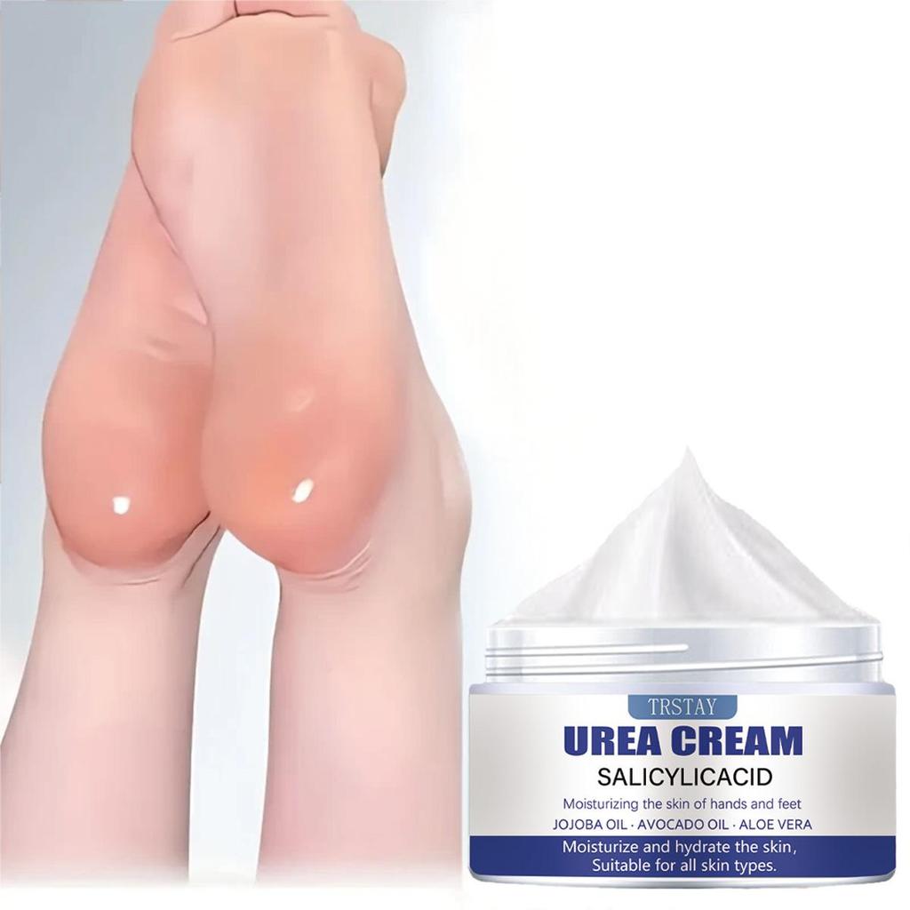 Moisturizing Foot Cream Softens and Repairs Thick and Cracked Skin, Gently Removes Scales and Dead Skin, and Is a Moisturizing Cream