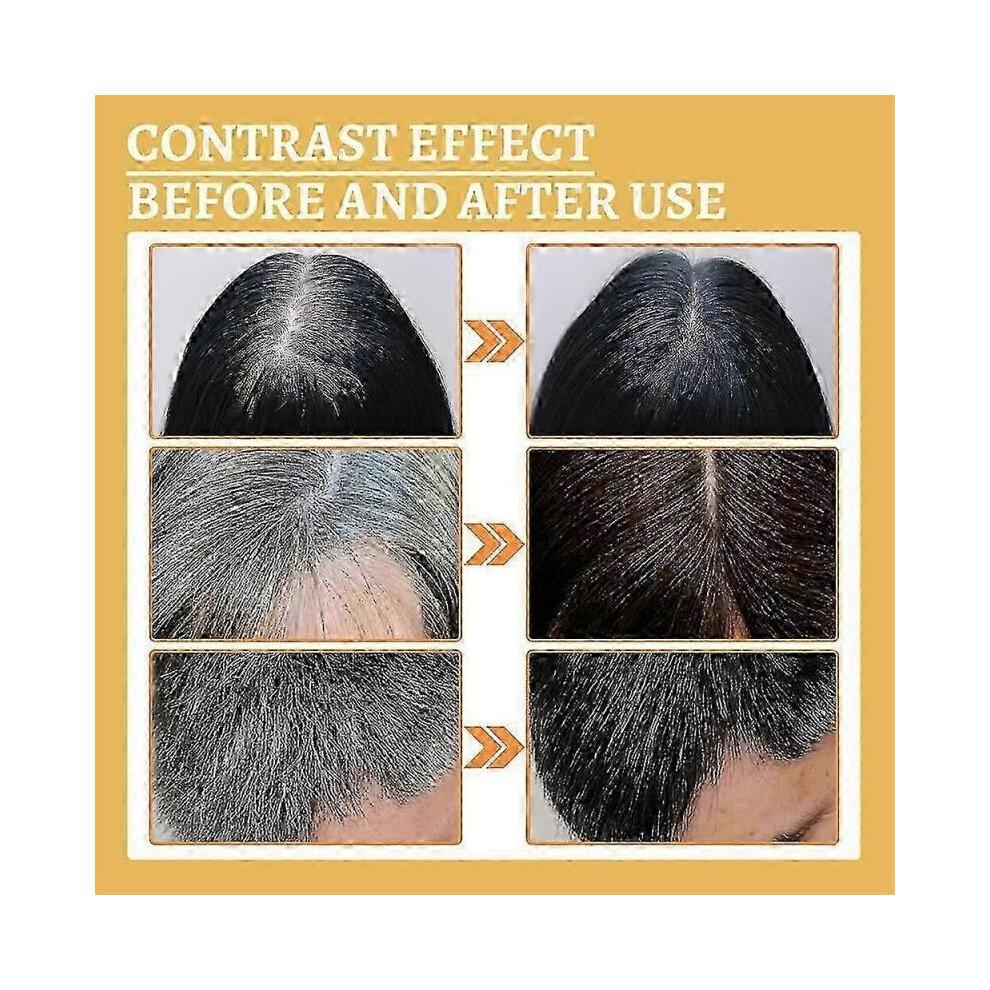 5pcs Grey Hair Reverse Serums Ganoderma Nutrient Natural Darkening Serums 30ml Anti-Greying Hair Serums for Promoting Healthier