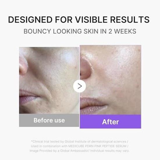 Medikube Booster Pro Mini Plus Main Unit (Pink) Skincare Beauty Device