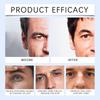 East Moon Moisturizing Men's Eye Cream Fades Fine Lines Of Eye Improves Puffiness Brightens And Tightens Eye Weeks