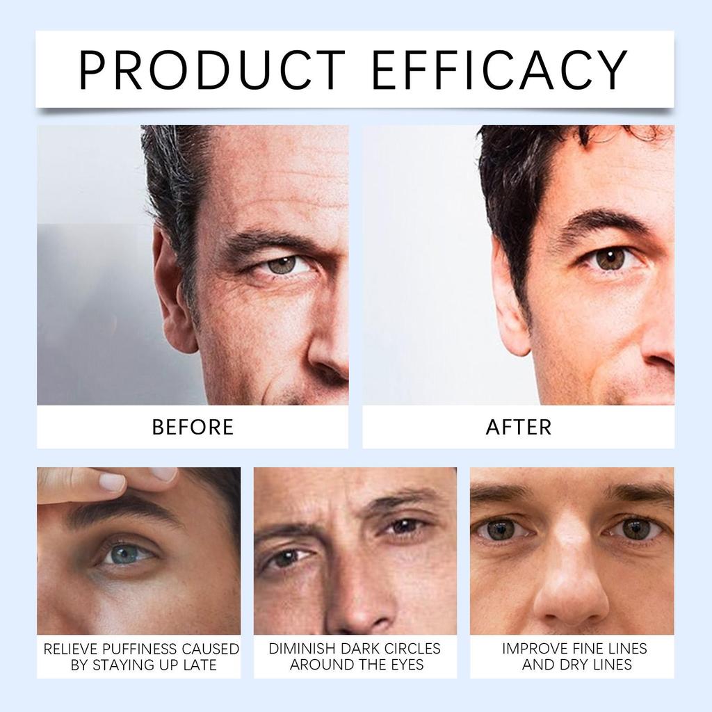 East Moon Moisturizing Men's Eye Cream Fades Fine Lines Of Eye Improves Puffiness Brightens And Tightens Eye Weeks