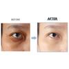 GONGSKIN Dark Spot Porcelain Eye Cream, 1pc, 10g