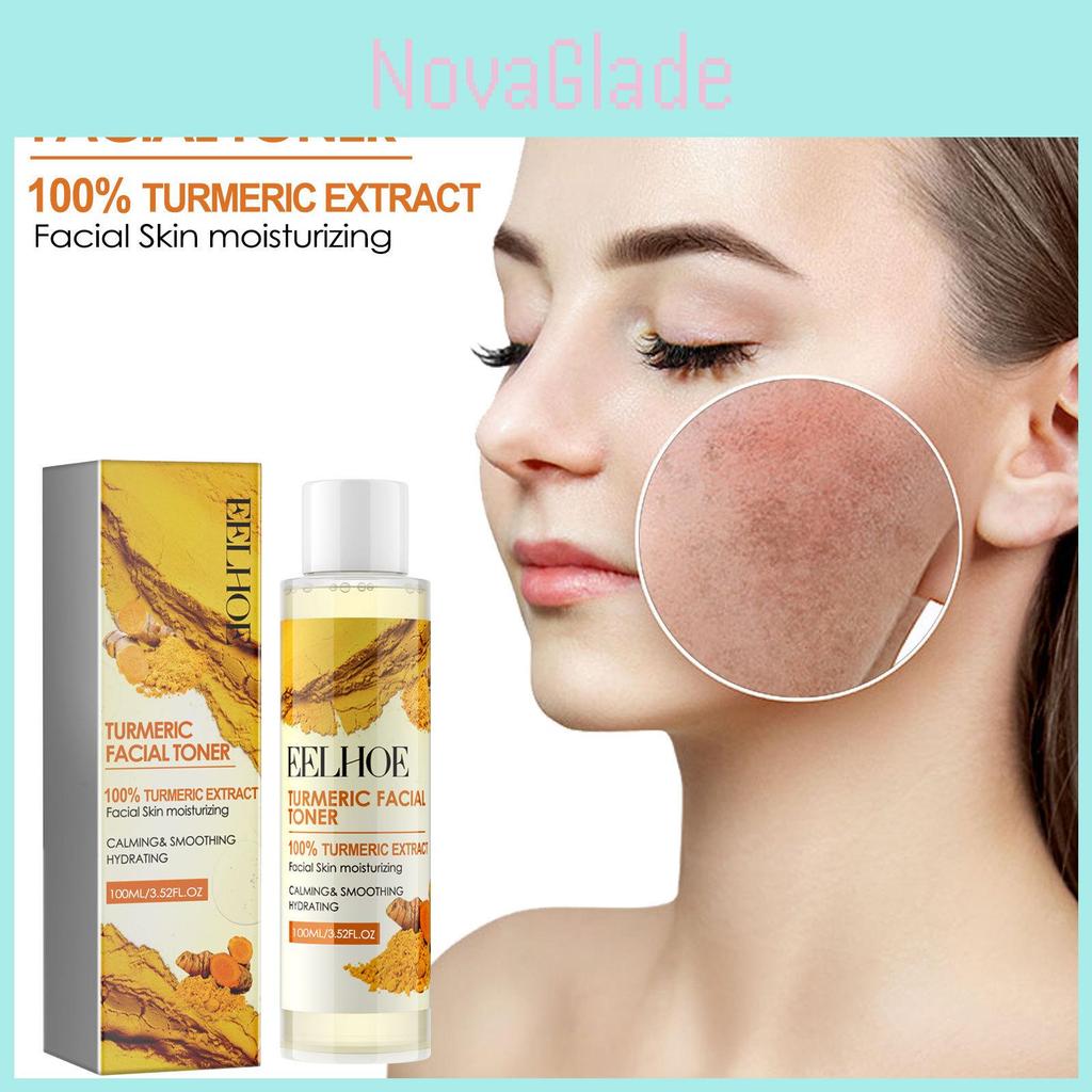 Eelhoe Ginger Turmeric Refreshing Facial Toner Hydrating Moisturizing Pore Refining And Fine Line Smoothing Water 100ml Ideal For Beautiful Skin