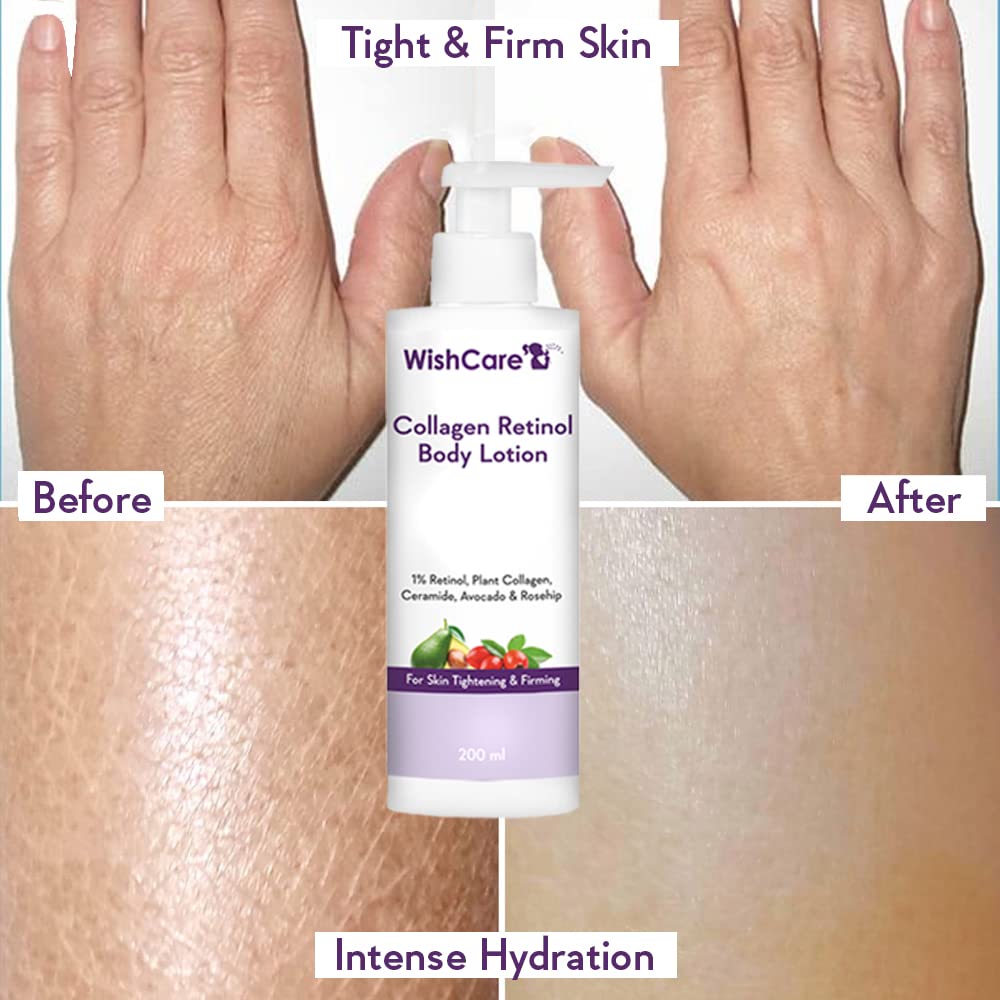 WishCare Collagen 1% Retinol Body Lotion 200 Ml For Skin Tightening Firming Men Women