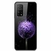 For Xiaomi Redmi Note 11 Case 11Pro 5G Tempered Glass Luxury Hard Back Cover For Xiaomi Redmi Note 11s Case Note11 Pro 5G Coque