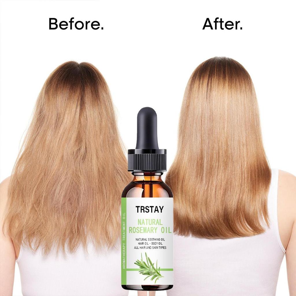 Anti Alopecia Oil Hair Growth Essential Oils for Black Women Essence Anti-Hair Loss Hair Serum for Thinning Hair Thickening