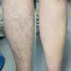 Tattoo cover, tattoo, vitiligo, scars, freckles, coffee spots, thin veins, blemishes concealer, SFX tattoo cover 1 set