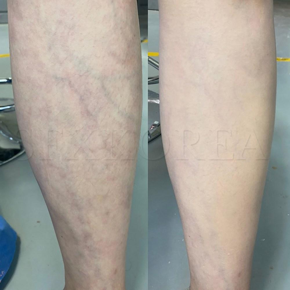 Tattoo cover, tattoo, vitiligo, scars, freckles, coffee spots, thin veins, blemishes concealer, SFX tattoo cover 1 set