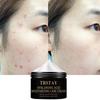 Whitening and Acne Removing Moisturizing Cream, Brightens Skin, Improves Skin Color, Moisturizing Cream