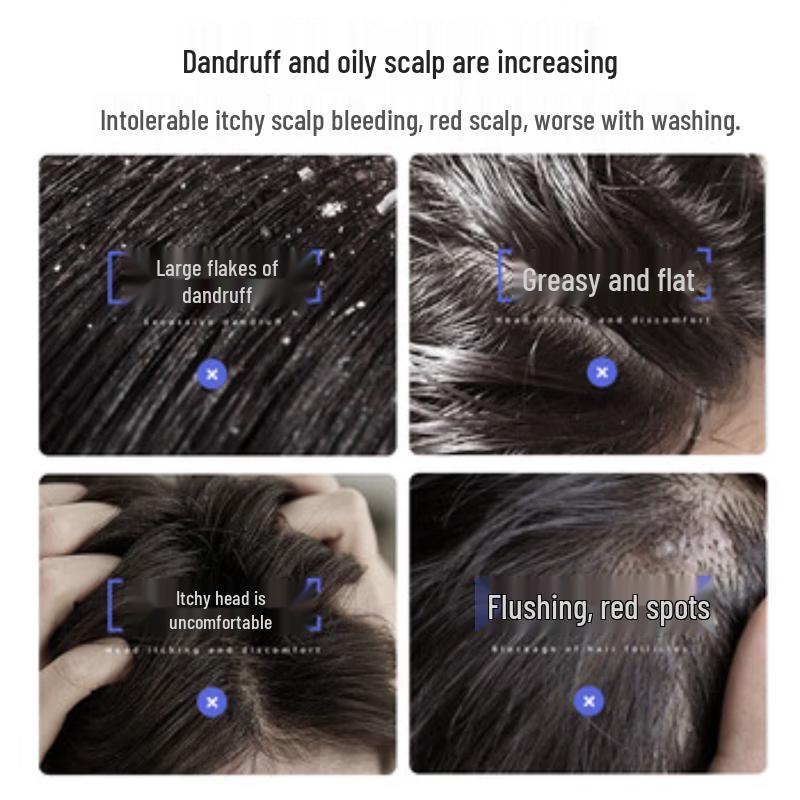 Cai Le Selenium Disulfide Anti-Dandruff Shampoo