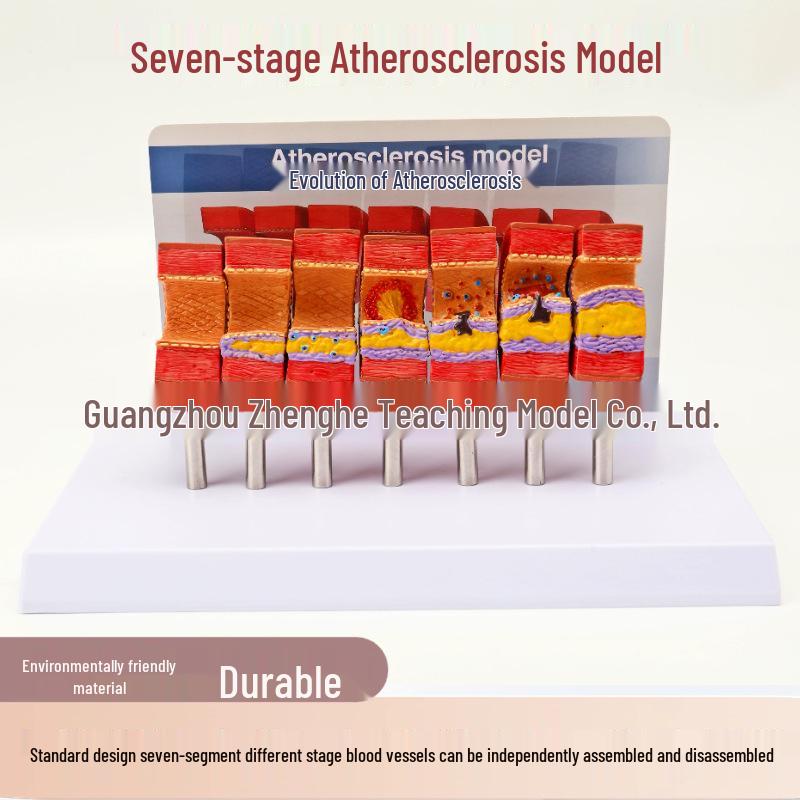 Arteriosclerosis & Thrombosis Pathological Blood Vessel Model Non-fading