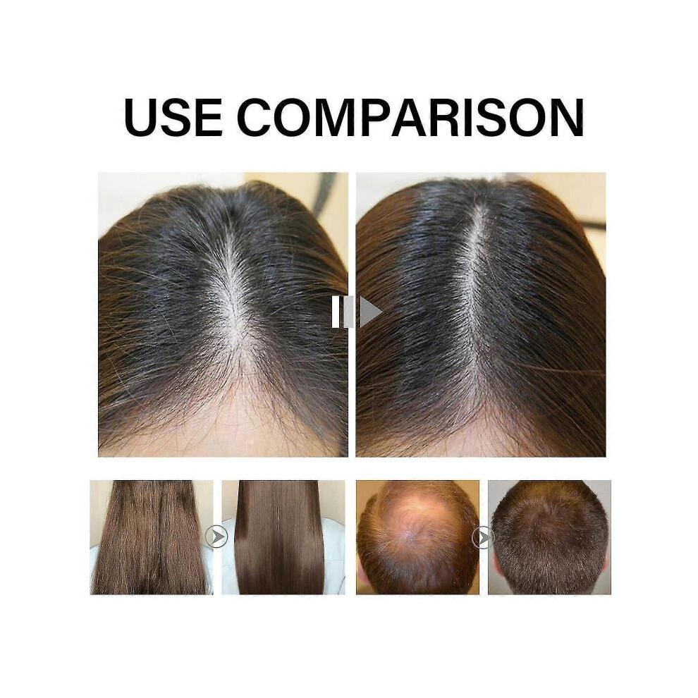 Biotin Hair Growth Serum Biotin Thickening Herbal Serum Biotin Hair Growth Spray for thicker, longer and stronger hair