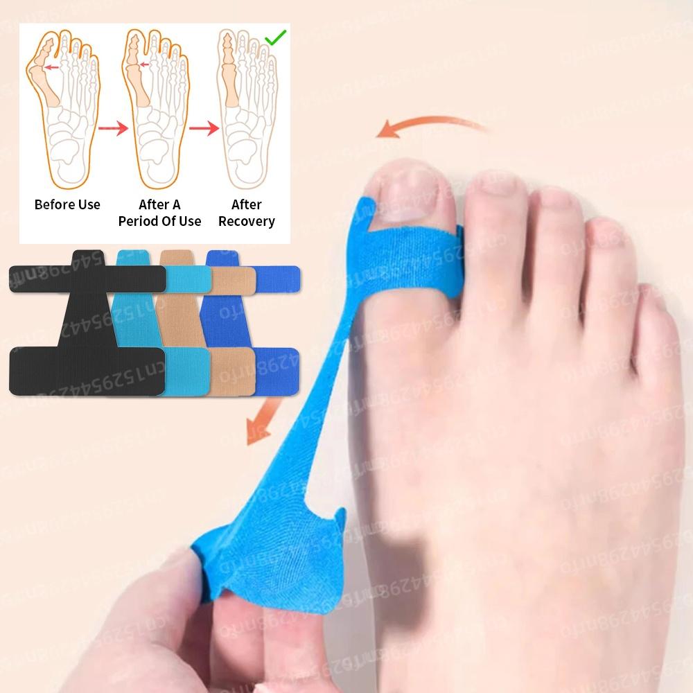 30Pcs Toe Separator Hallux Valgus Fixed Support Protect Toes Anti Rubbing Toe Protective Patch for Big Toe Correction Valgus