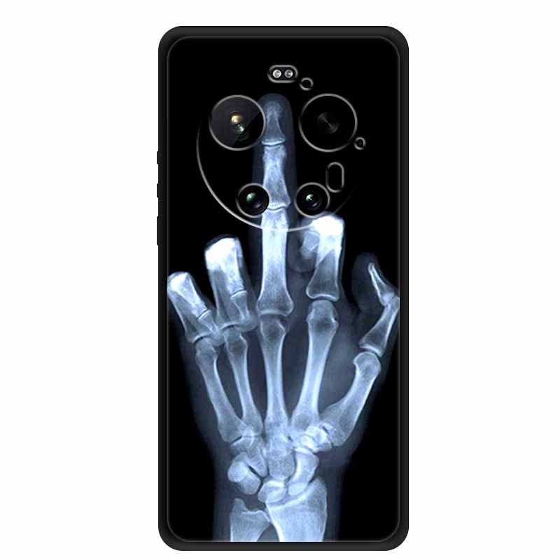 For Xiaomi 17 Ultra Case Black TPU Silicone Back Cover Soft Case For Xiaomi 17 Ultra Lens Full Protection Fashion Phone Fundas
