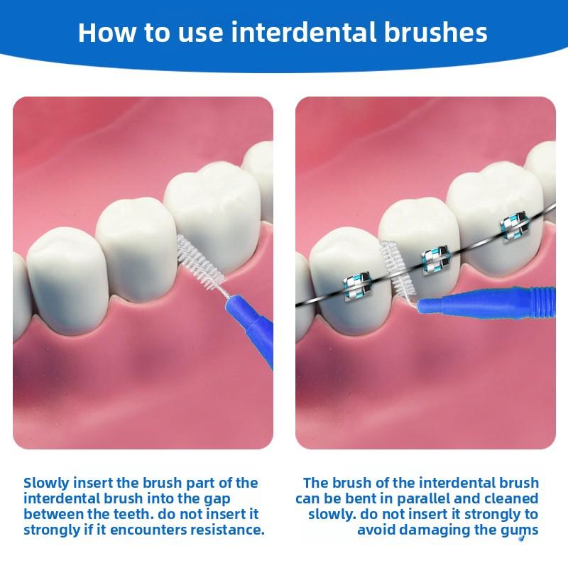 10 Stück Kieferorthopädische Pflege Zahnspangen Interdentalbürsten