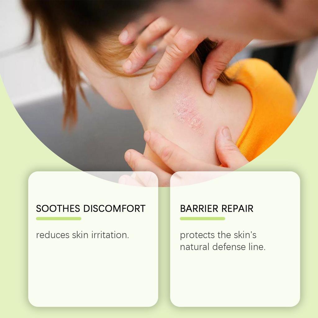 Skin Moisturizing Cream Soothes Discomfort, Moisturizes Dry Skin, And Maintains The Skin Barrier