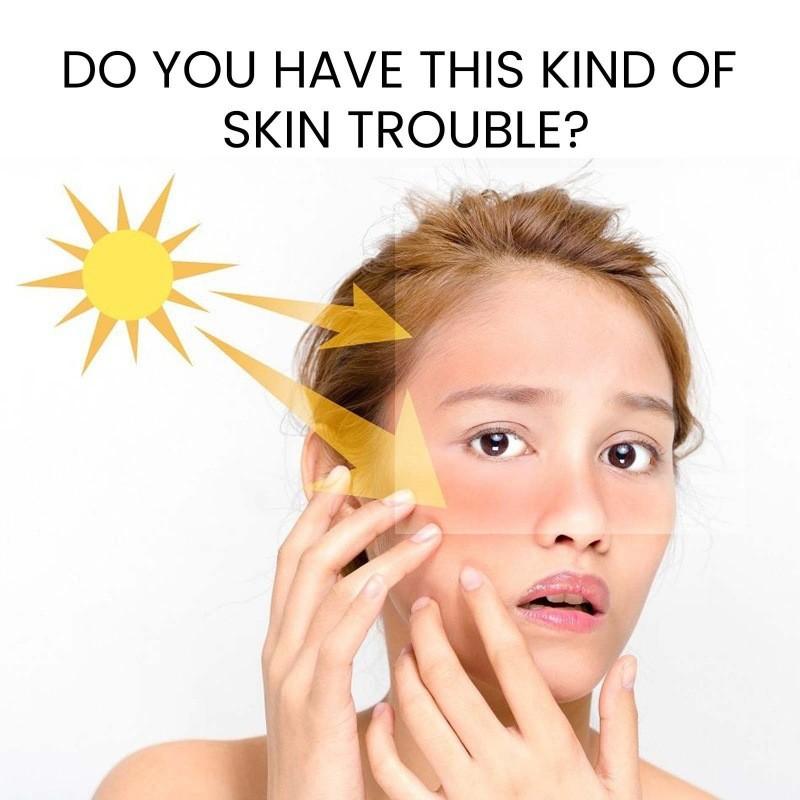 Eelhoe Protective Moisturizing Cream For Body With Soothing Hydration And Sun Defense