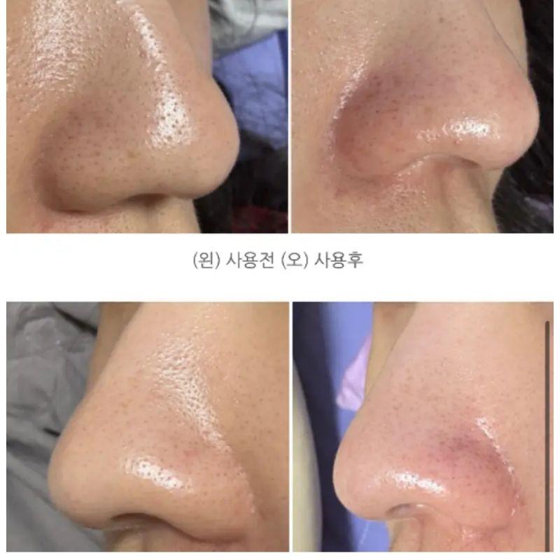 Dr.Althea Premium Quick Step Sebum Cleanser 100ml