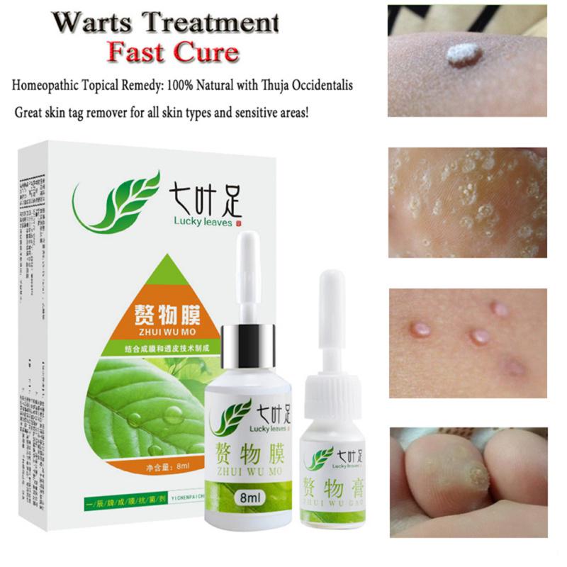 Buy Callus Remover Cream Painlessly Remove Verruca Of Hand And Foot